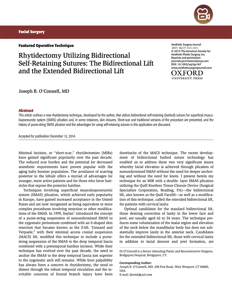 Westport Bidirectional Lift article