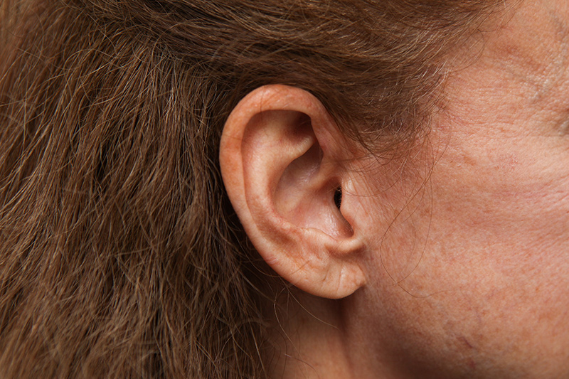 Westport Bidirectional Lift right ear
